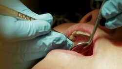 Healthcare Dental Cleaning Service at Clinic Stock Footage