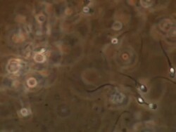 Human sperm, lots swimming around, red brown background Stock Footage