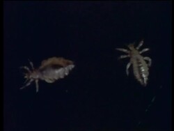 CU Body lice against black background, United Kingdom Stock Footage