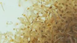 Culicine Mosquito Larvae Stock Footage