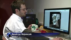 VOICED : Impresora 3D mejora cirugias reconstructivas News Clip