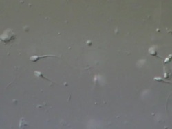 Human sperm swimming, race, Interference contrast Stock Footage