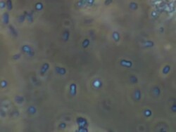 Friendly bacteria, Lactobacillus casei. A rod-shaped gram-positive, non-sporing, non-motile, obligate anaerobe, which inhabits human intestinal tracts. It is beneficial to human health eg improves and promotes digestion. Stock Footage