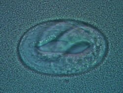 Caenorhabditis elegans egg with embryo moving inside, surrounded by bacterial suspension (E.coli OP50). Stock Footage