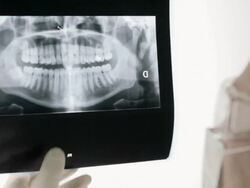 Dentist examining X-Ray image Stock Footage