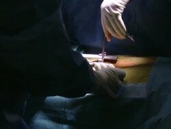  CU Surgeons using tools and operating / Cagliari, Sardinia, Italy Stock Footage