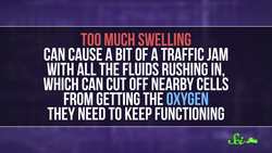 How Does Icing an Injury Help? Instructional Video