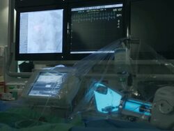 Working equipment in operating room Stock Footage