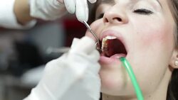 Mending patient's teeth Stock Footage