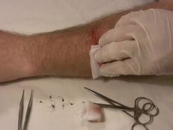 Salve applied to a wound 2 Stock Footage