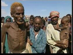 ETHIOPIA: IMI: FAMINE &amp; LACK OF MEDICAL AID News Clip