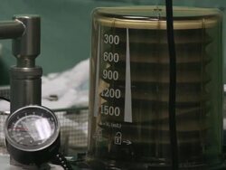 CU TD Oxygen machine connected to patient / Cagliari, Sardinia, Italy Stock Footage