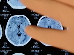 CAT scan on digital tablet Stock Footage