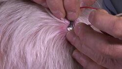 Study uses magnetic stimulation to detect dementia News Clip