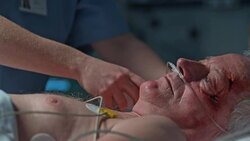 Nurse measuring intensive care patient's temperature Stock Footage