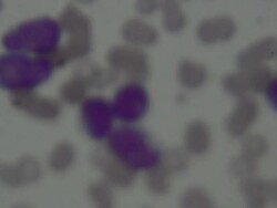 Blood cells Stock Footage