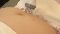 Factfile about the Zika virus News Clip