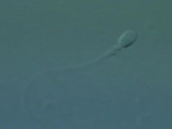 Single Human sperm swimming, big close up, Interference contrast Stock Footage
