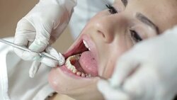 Mending patient's teeth Stock Footage