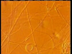 CU microscopic view of Nematode trapping fungus Arthrobotrys, tilt down Stock Footage