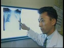 JAPAN: 8 YEAR OLD GIRL LEAVES TO UNDERGO HEART OPERATION IN USA News Clip