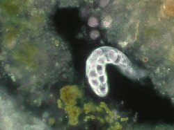 Ciliate unidentified Stock Footage