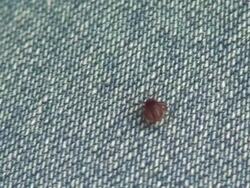 crawling tick Stock Footage