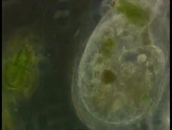 Ciliate protozoan amongst flagellate protozoans, Euglena and spirochaete bacteria Stock Footage