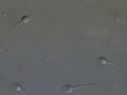 Human sperm, close up Stock Footage
