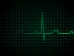Heart Flatline HD (With Audio) Stock Footage