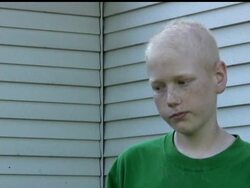 Minnesota teen angry about continuing chemotherapy News Clip