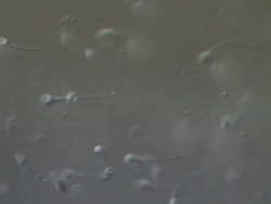 Human sperm swimming, race; two tailed Human sperm top left of frame later in shot, Interference contrast Stock Footage
