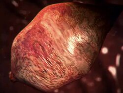 Extreme Close Up push-in push-out - A lung fluke worm expands inside a lung in a computer-generated animation. Stock Footage