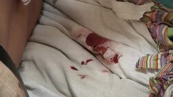 People Being Treated In Makeshift Hospital News Clip