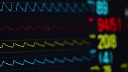 Vital signs monitor Stock Footage