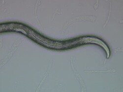 Caenorhabditis elegans (C.elegans) and E.coli bacteria Stock Footage