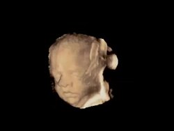 Foetus head up close, rotating 3D ultrasound.. Stock Footage