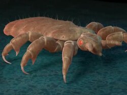 POV rotates around a headlouse Stock Footage