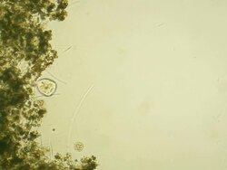 Microorganism - Vorticella Stock Footage