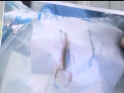 All Jeff Ellis could do was wait as he sat terrified 30,000 feet in the air staring at the wriggling scorpion that stung him on a flight to Alaska. News Clip