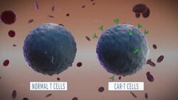 A Look at How CAR-T Cell Therapy Works News Clip