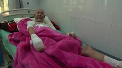 GRAPHIC: Burns unit treats airstrike injured Instructional Video