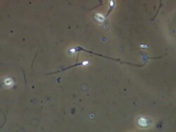 Single Human sperm swimming, Phase contrast Stock Footage