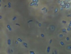 Friendly bacteria, Lactobacillus casei. A rod-shaped gram-positive, non-sporing, non-motile, obligate anaerobe, which inhabits human intestinal tracts. It is beneficial to human health eg improves and promotes digestion. Stock Footage