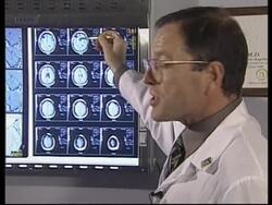 USA: NEW WEAPON IN THE WAR AGAINST BRAIN TUMOUR News Clip