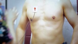 EKG monitoring patient heart rate and blood oxygen at hospital Stock Footage