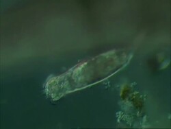 Rotifer nomarski in sensitive grey Stock Footage