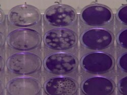 Ebola virus lab testing News Clip