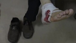 CLEAN : Dozens hurt, many arrested in Armenia clashes News Clip