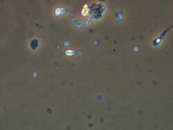 Single Human sperm swimming, best, Phase contrast Stock Footage